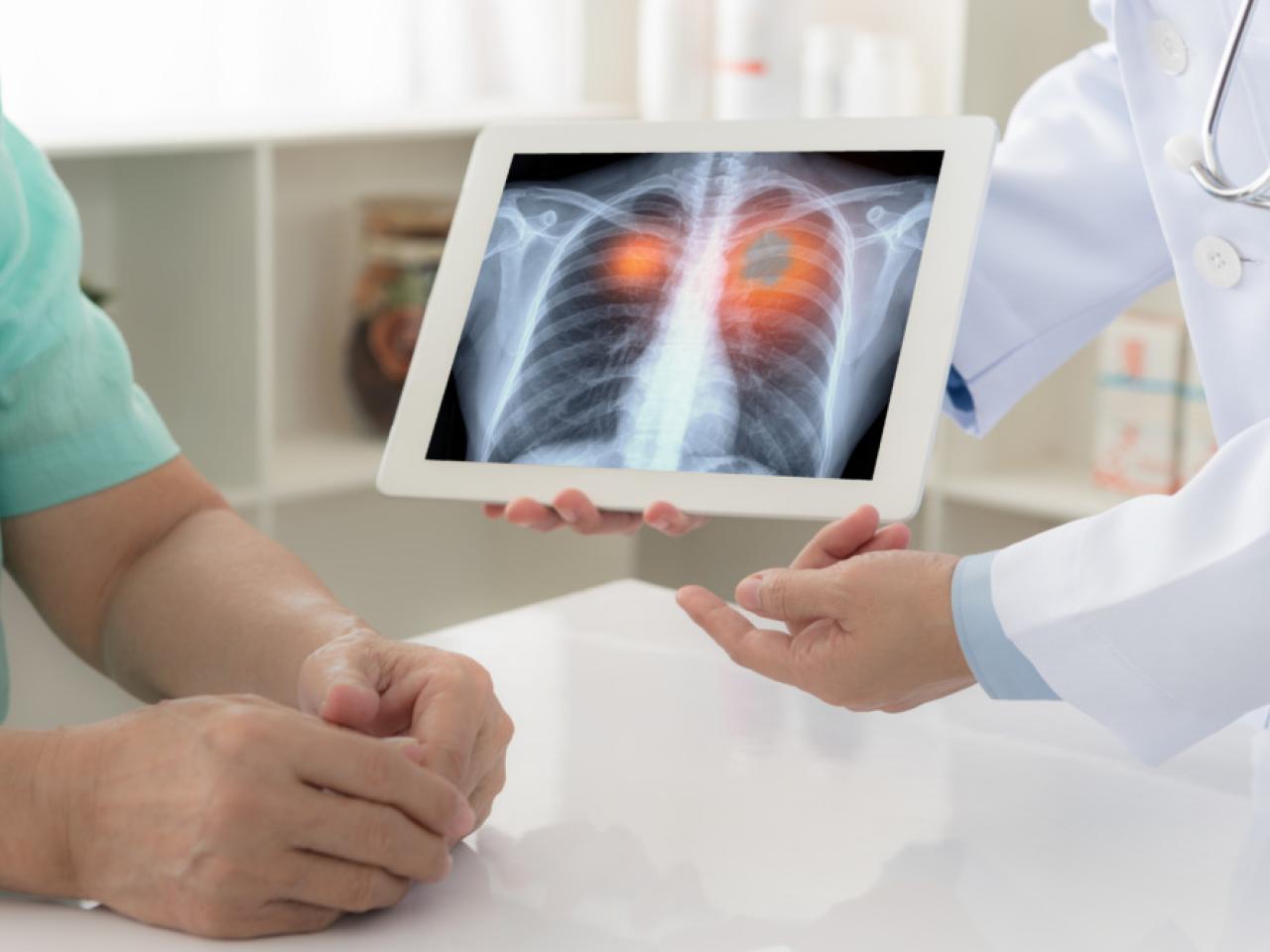 An x-ray of a patients lungs being shown to a patient.