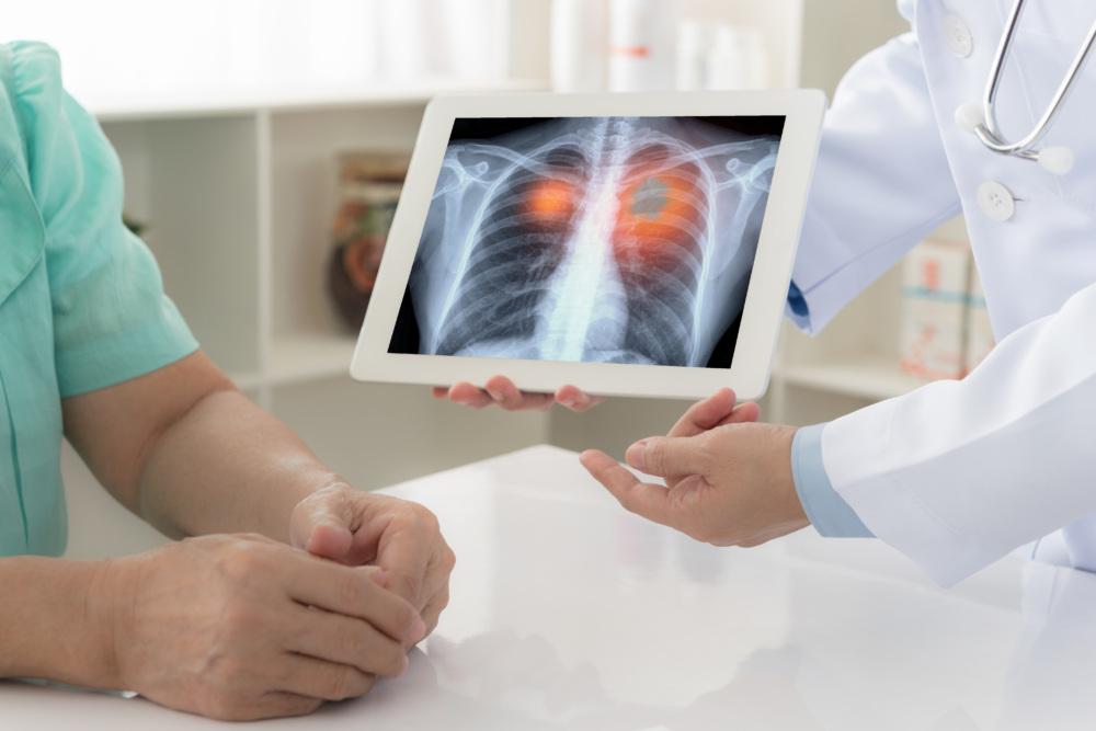 An x-ray of a patients lungs being shown to a patient.