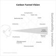 Carbon Tunnel Vision