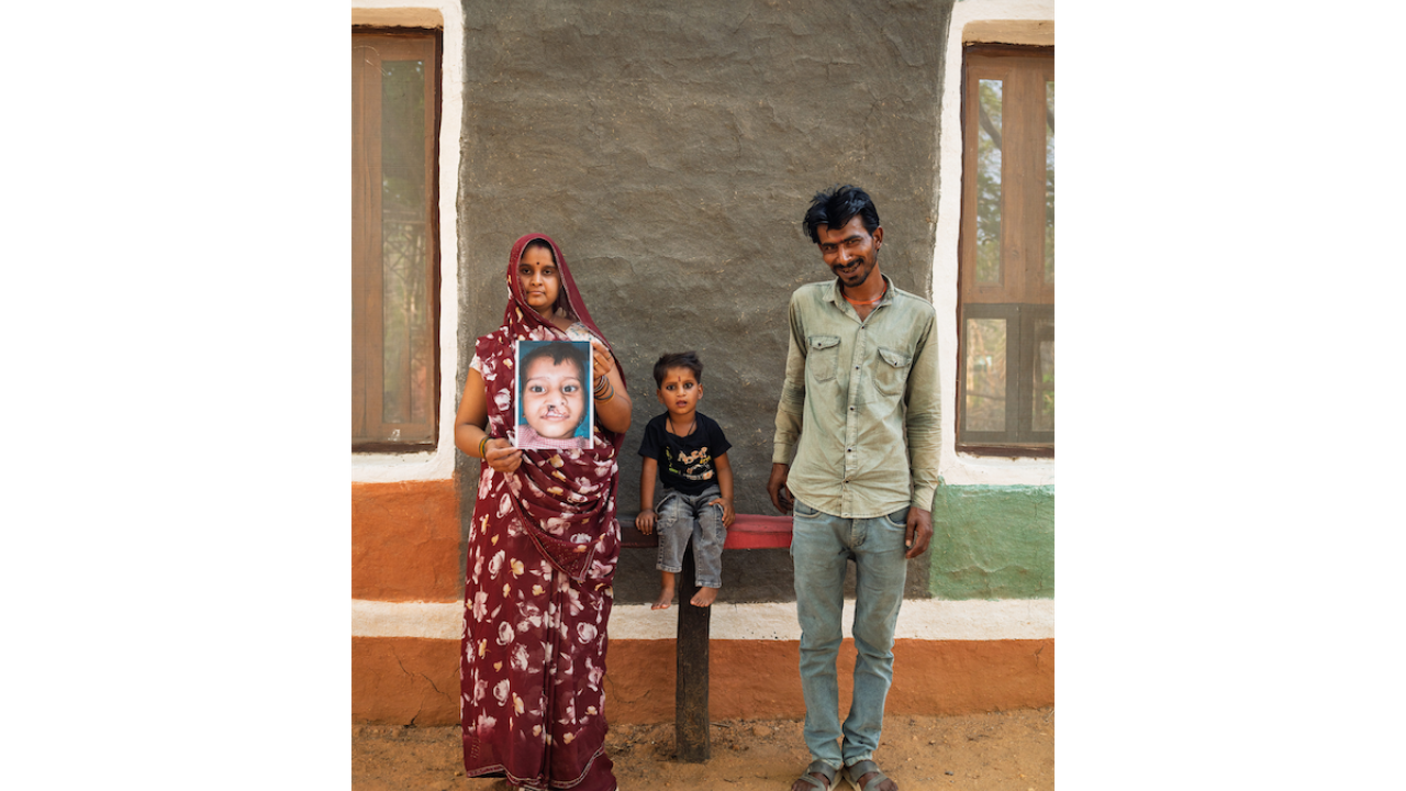 Robi is the 7,000th patient to receive cleft surgery through the partnership between Smile Train and Dentsply Sirona.