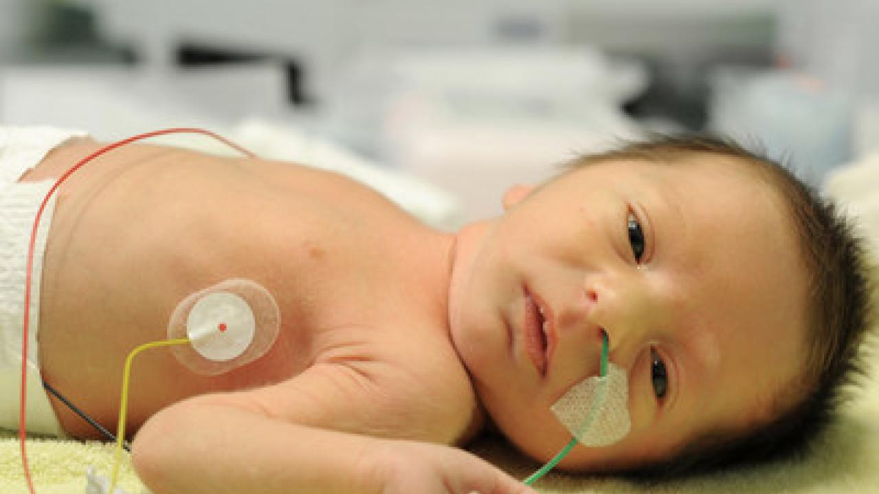 Photo of an infant in an Intensive Care Unit.