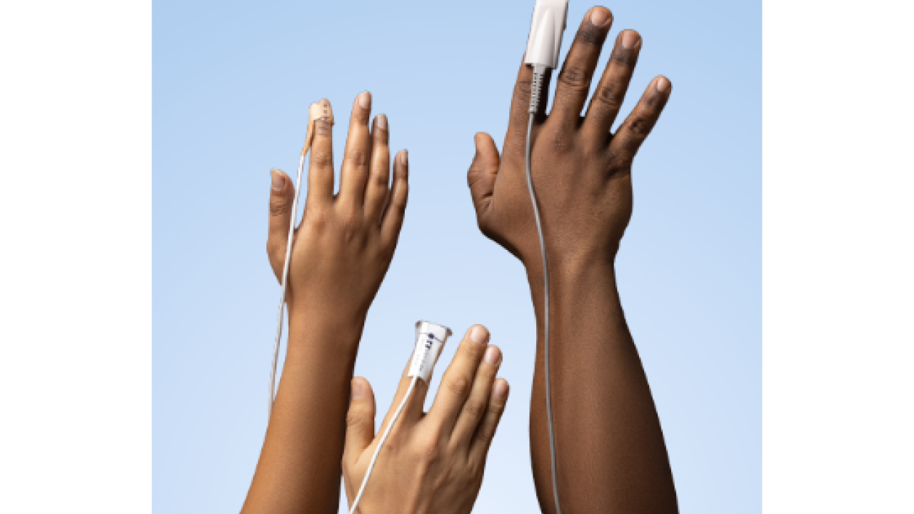 Pulse oximeters on hands