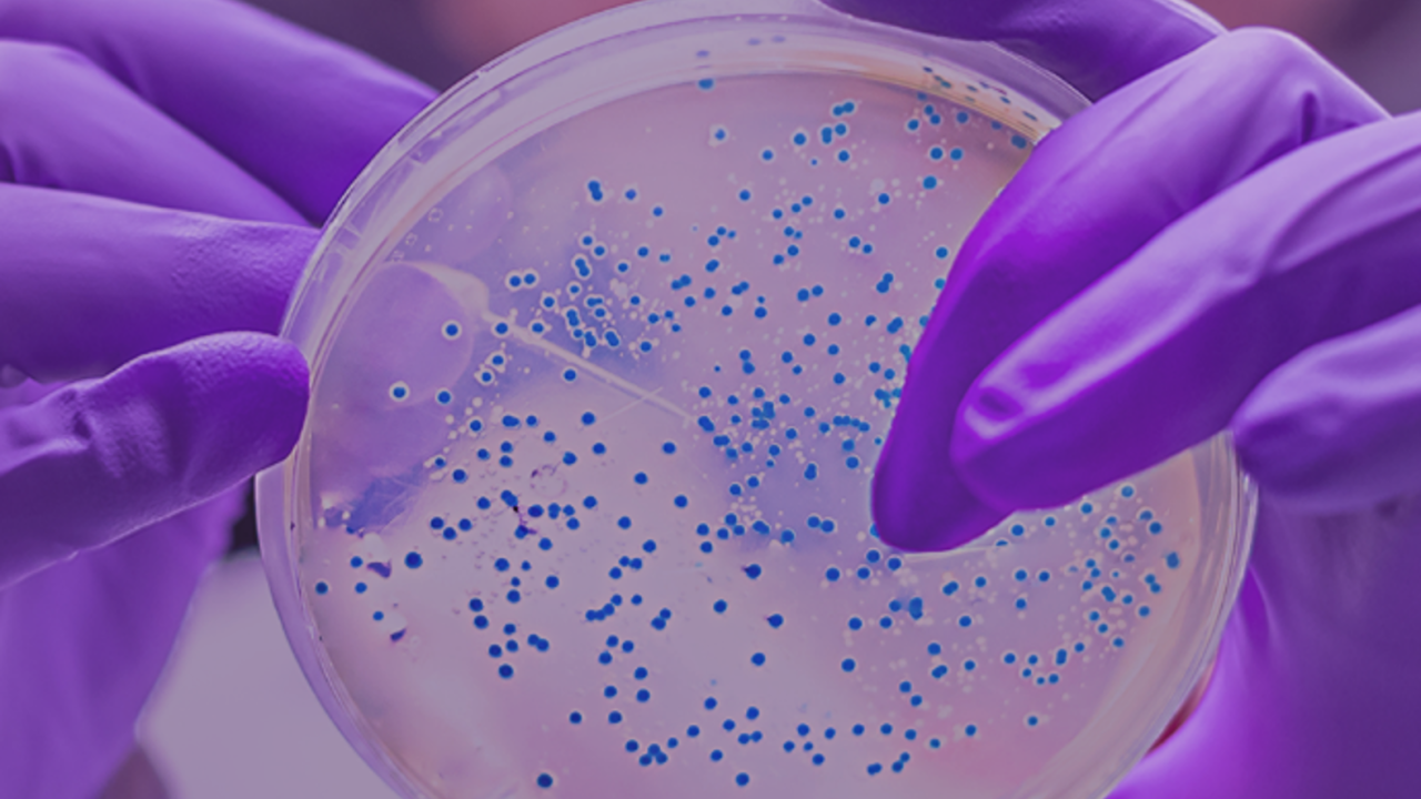 hands in purple gloves handling a blue-speckled petri dish