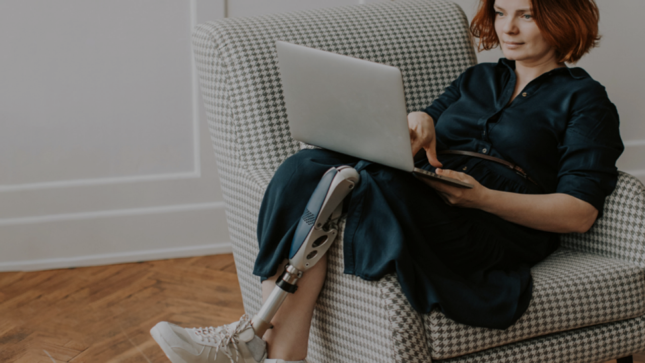 a person lounging in a chair a laptop in their lap, they have one prosthetic leg