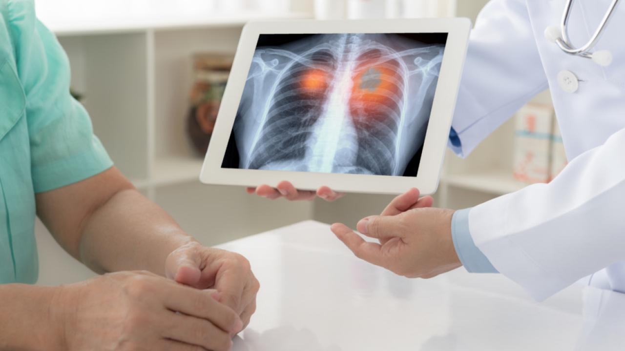 An x-ray of a patients lungs being shown to a patient.